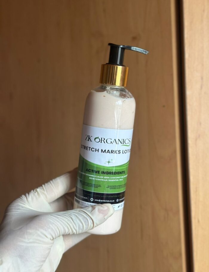 Stretch Marks Lotion